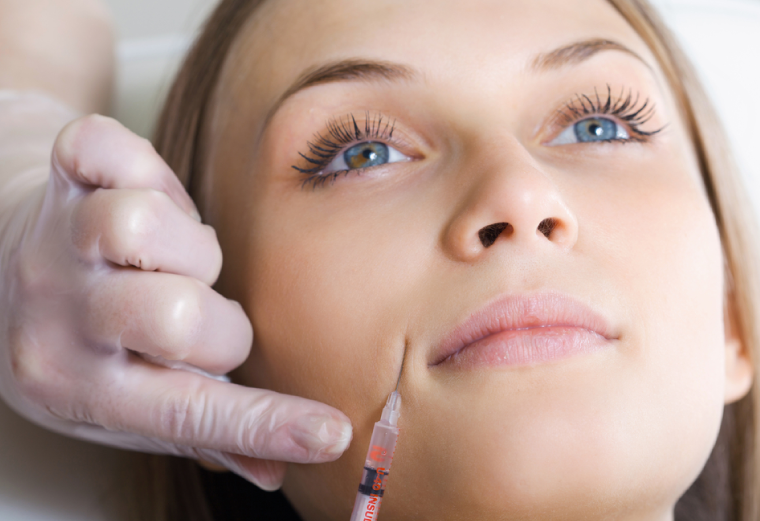 Entenda riscos do PMMA e por que prefiro preenchimento com ácido hialurônico