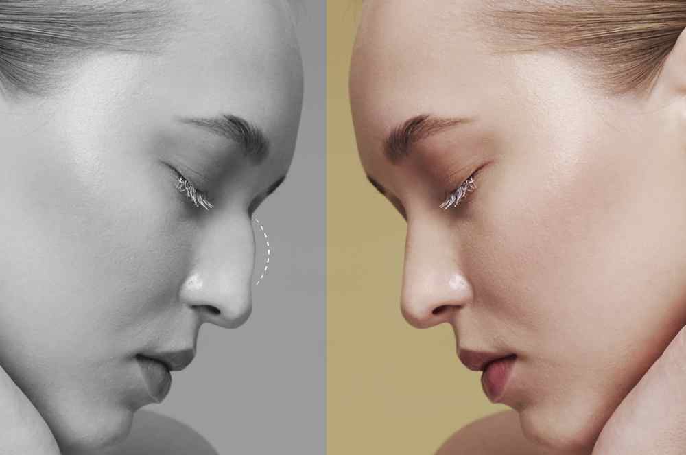 Beleza Natural x Visual Impactante: Existe Certo ou Errado?
