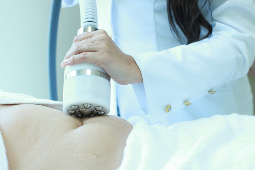 Crio Radiofrequência