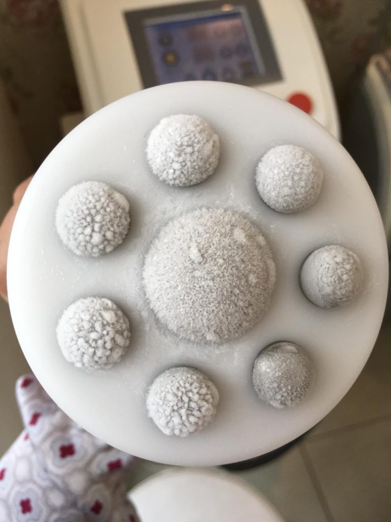 Crio Radiofrequência