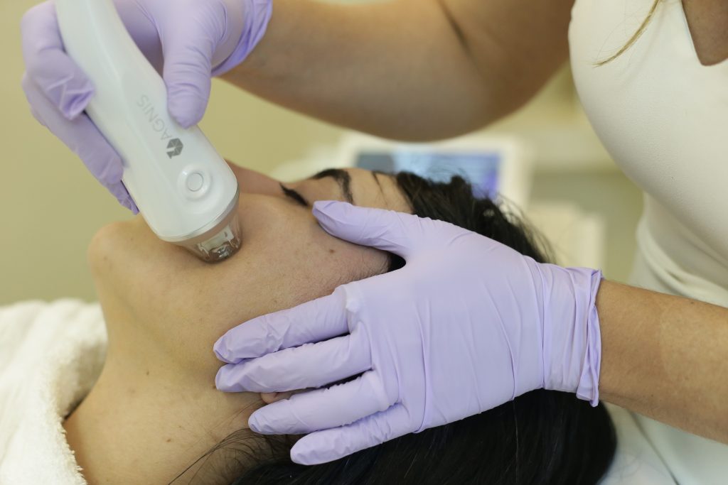 tratamento de melasma