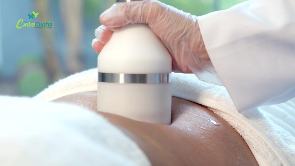 Crio radiofrequência